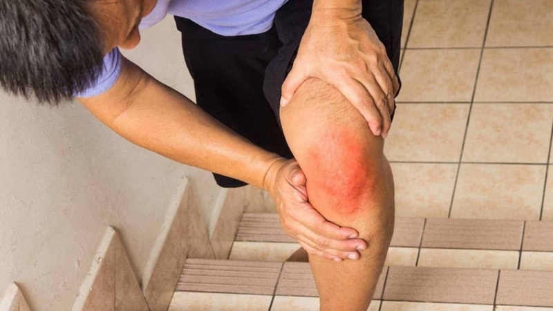 Đau khớp gối khi leo cầu thang cảnh báo bệnh gì? 2