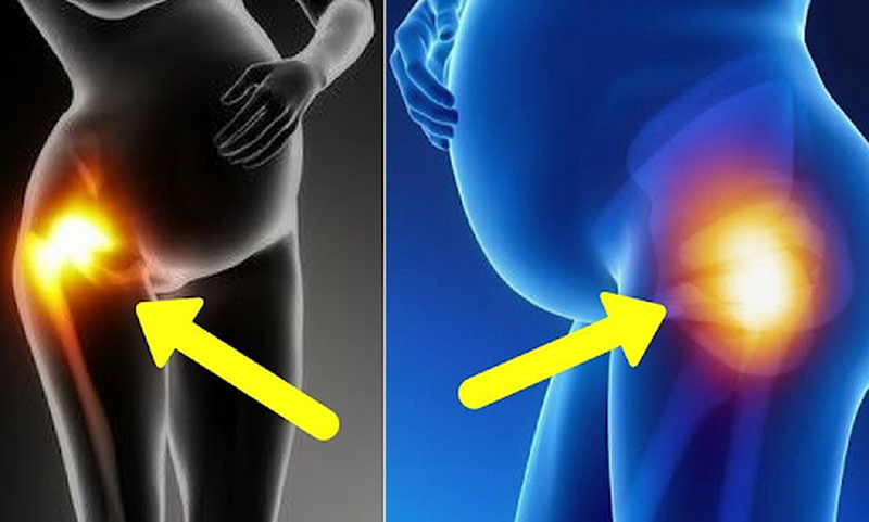 Đau khớp háng khi mang thai 3 tháng đầu và những điều mà bạn cần biết 2