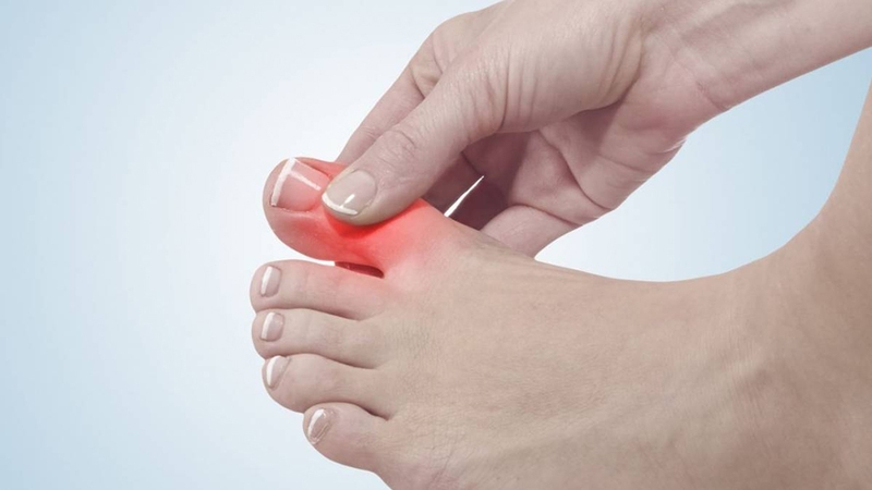 Đau khớp ngón chân cái không sưng có sao không 1