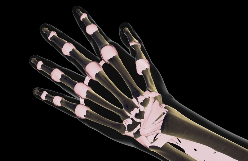 Đau khớp ngón tay là bị bệnh gì? Chữa trị ra sao? 2