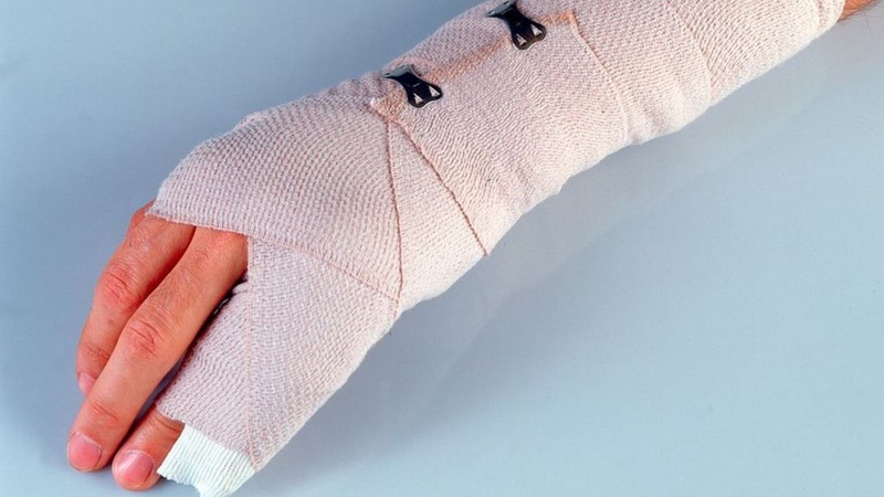 Đau khớp ngón tay út: Nguyên nhân và cách chữa trị 2