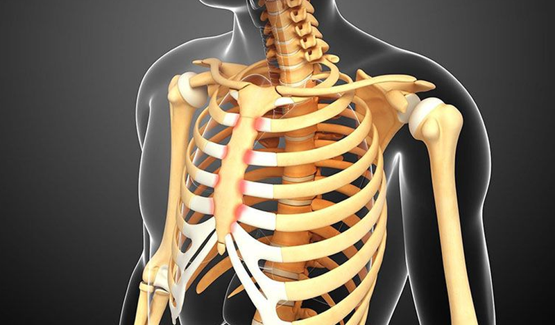 Đau khớp sụn sườn gây cảm giác đau nhói ở vùng thành ngực