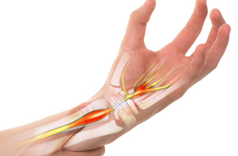 Đau khớp tê tay là bệnh gì? Nguyên nhân do đâu? 3