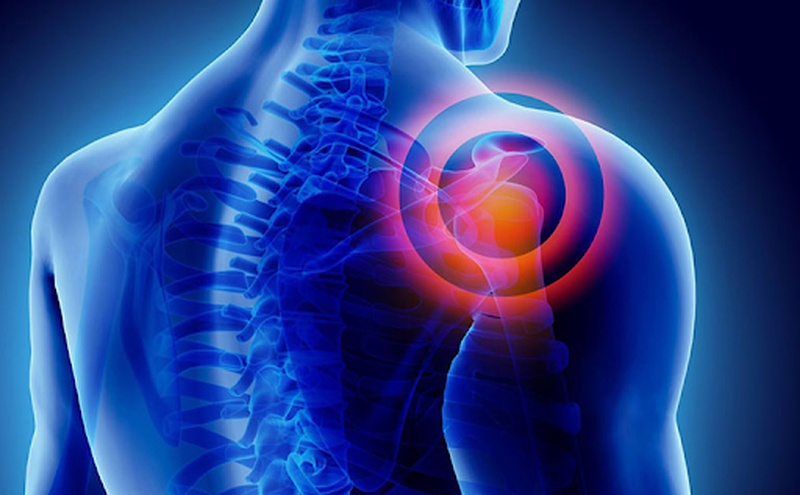 Nguyên nhân, triệu chứng và cách điều trị hiệu quả bệnh đau khớp vai bạn đã biết chưa? 1