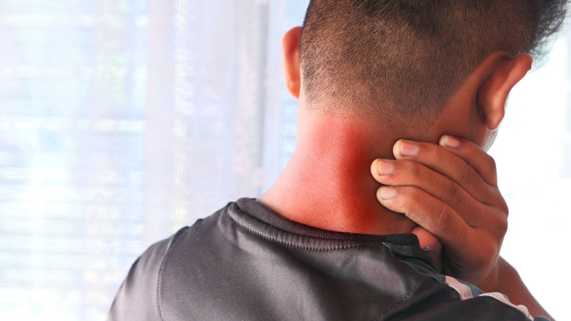 Một số trường hợp đau khớp vai xuất phát từ nguyên nhân thần kinh