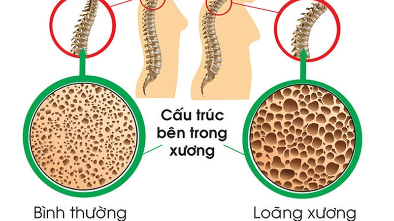 Đâu là tư thế ngủ cho người đau lưng nên biết? 1
