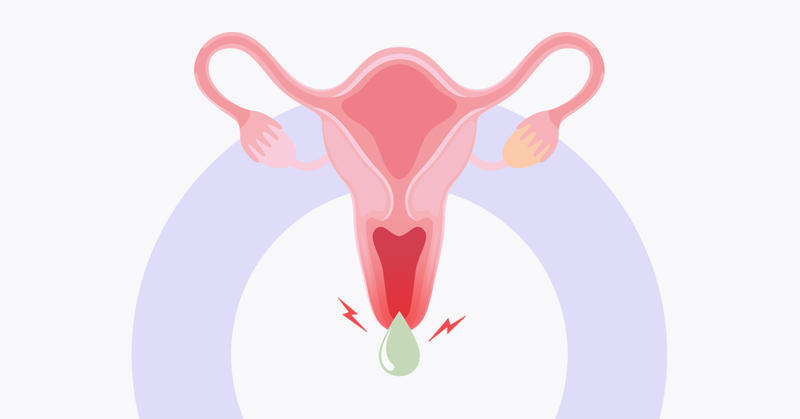 Đau lưng, đau bụng dưới, ra khí hư là triệu chứng của bệnh gì? 3