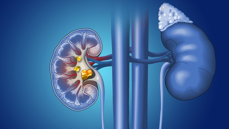 Đau lưng về đêm do đâu? Nên làm gì để khắc phục? 2