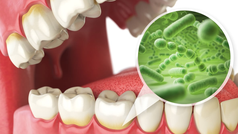 Đầu lưỡi nổi hột đỏ: Nguyên nhân và dấu hiệu nhận biết bệnh lý 4