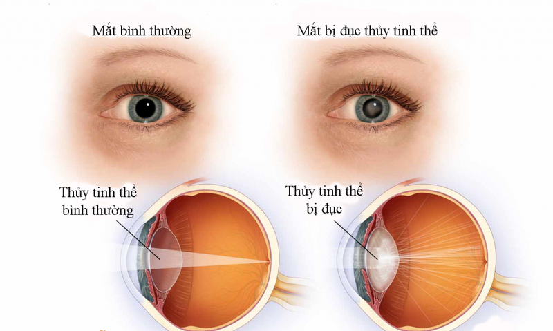 đau mắt đỏ có nên uống rượu không 02