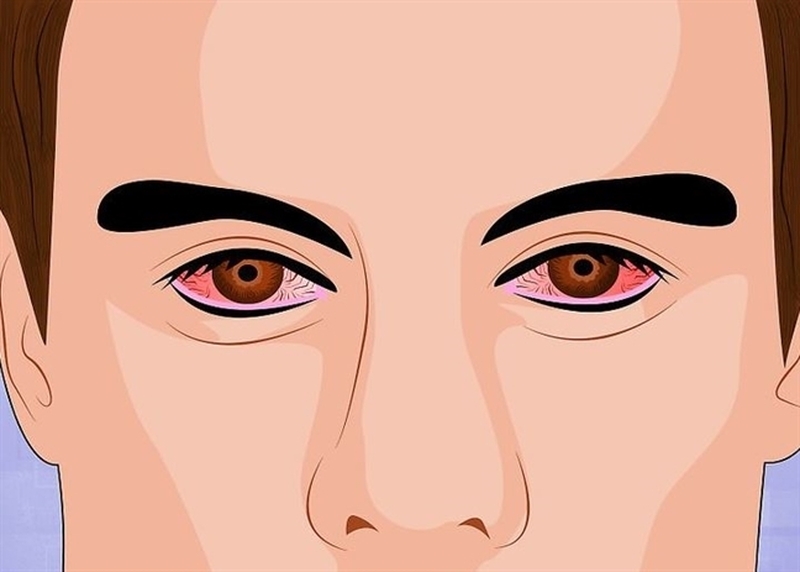 đau mắt đỏ có nên uống rượu không 01