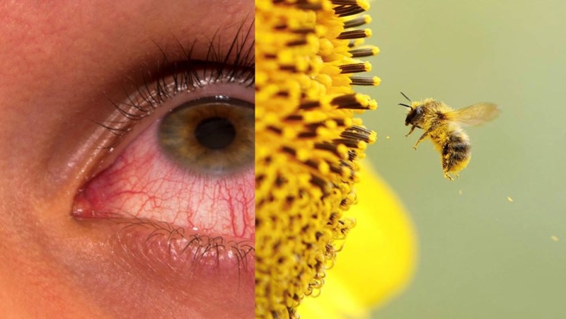 đau mắt đỏ dị ứng 02