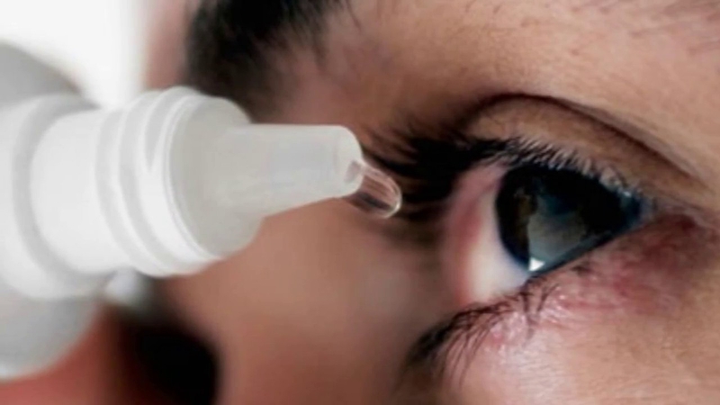 Đau mắt đỏ kéo màng có nguy hiểm không? 2