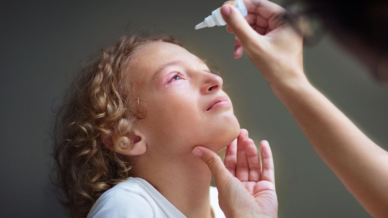 Đau mắt đỏ khi nào hết lây? Phải phòng bệnh như thế nào? 3