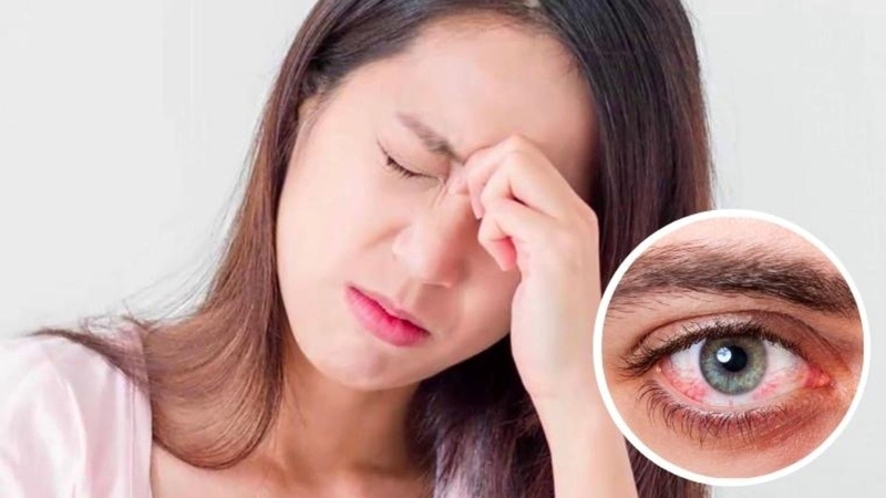 Đau mắt đỏ lây qua đâu? Làm sao để hạn chế lây lan 2