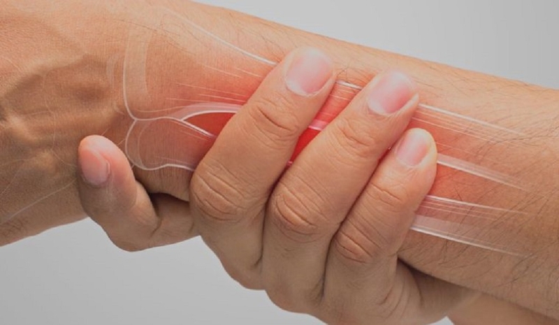 Đau mặt ngoài cổ tay là dấu hiệu của bệnh gì? Cách chẩn đoán và điều trị bệnh 2