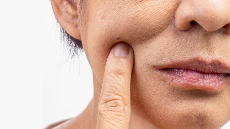 Thử phản ứng dị ứng trên vùng da nhỏ trước khi sử dụng dầu mè