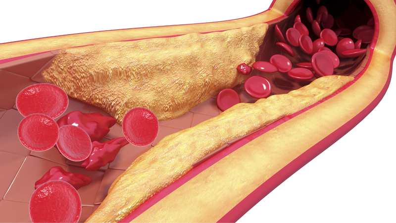 Đau nhức chỗ gãy xương có nguy hiểm không? 1