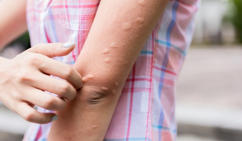 Dầu nóng Trường Sơn có tác dụng gì? Lưu ý khi sử dụng 2