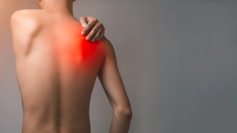 Đau vai gáy bên phải: Nguyên nhân, triệu chứng và cách chữa trị 1