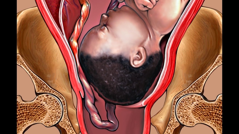 Dây rốn có chức năng gì? Cách chăm sóc dây rốn đúng cách cho trẻ sơ sinh 2