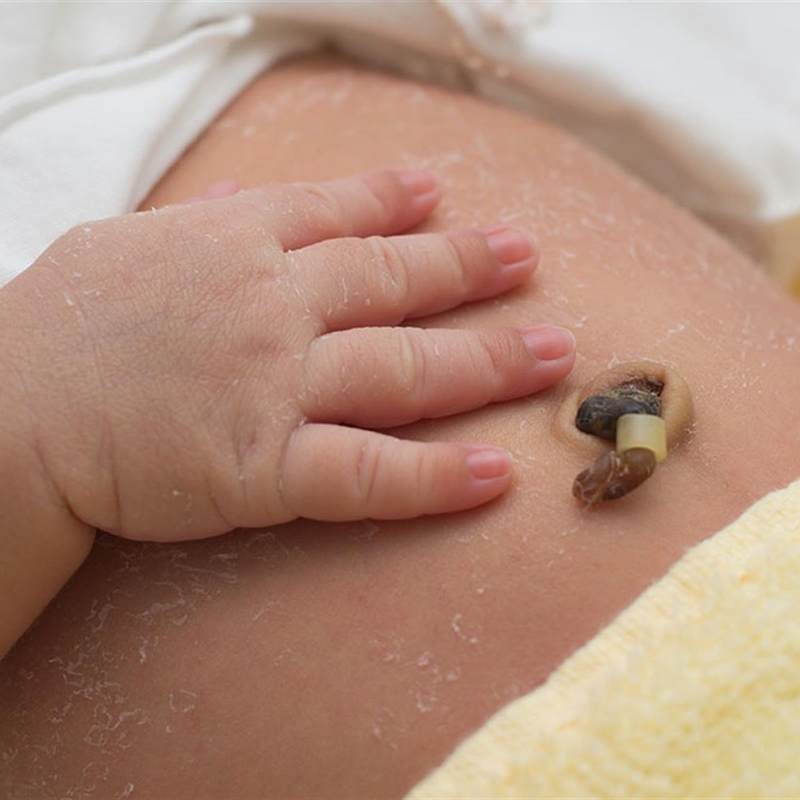 Dây rốn có chức năng gì? Cách chăm sóc dây rốn đúng cách cho trẻ sơ sinh 4