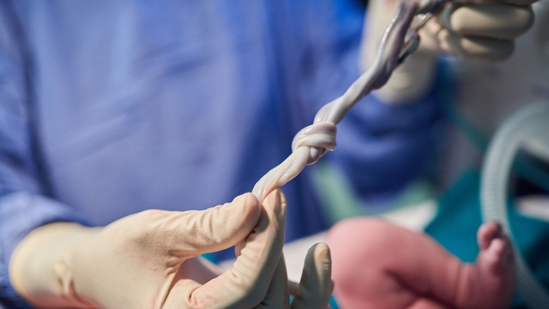 Dây rốn quấn cổ 1 vòng sinh thường được không là băn khoăn của không ít độc giả