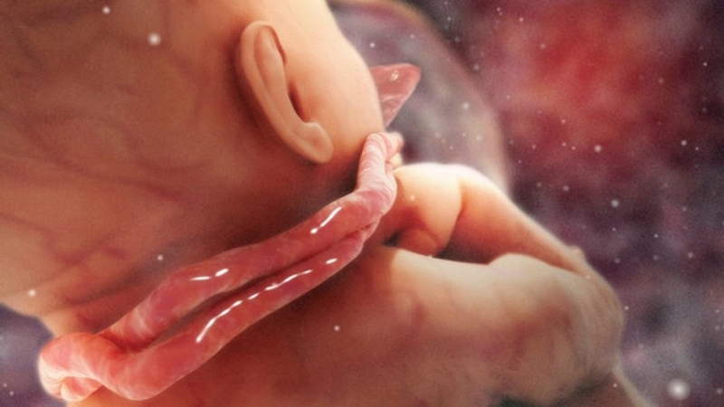 Dây rốn quấn cổ 1 vòng tuần 32 có nguy hiểm không? Cách xử lý như thế nào? 1