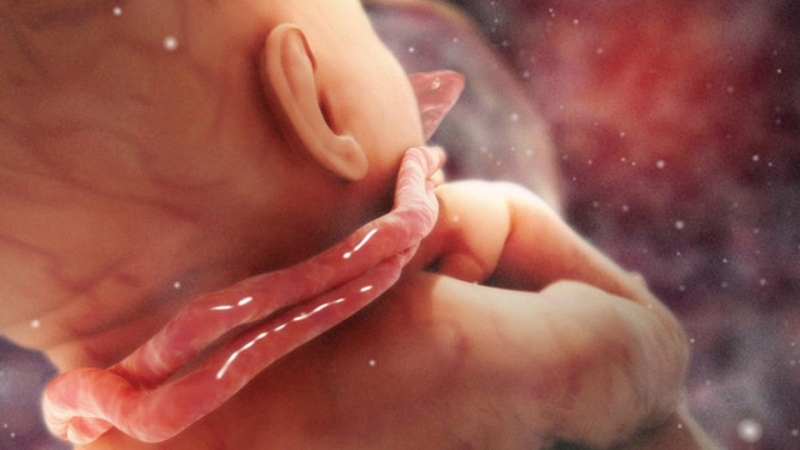 Dây rốn quấn cổ 1 vòng tuần 38 có nguy hiểm cho mẹ và bé hay không? 1