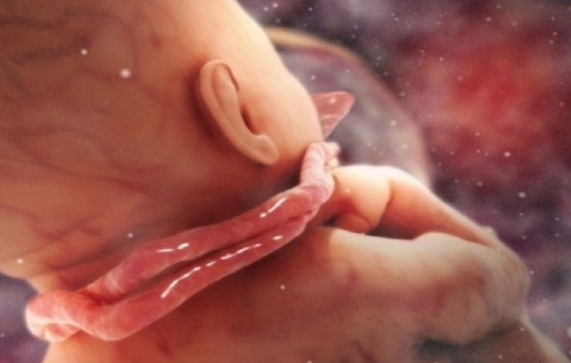 Dây rốn quấn cổ 2 vòng là gì? Mẹo dân gian chữa dây rốn quấn cổ 1