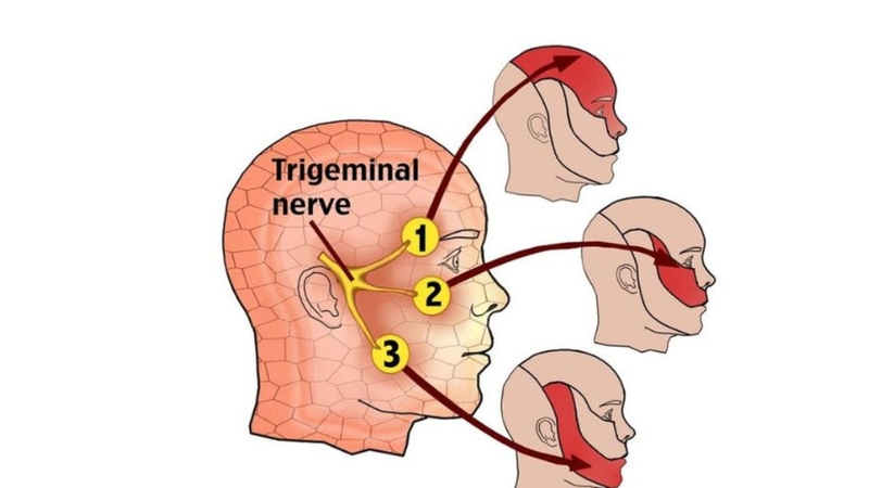Dây thần kinh số 5​: Cấu trúc, chức năng và các rối loạn thường gặp 1