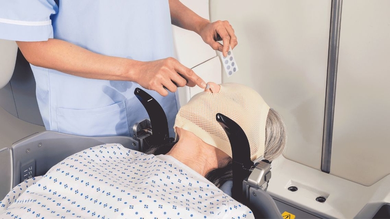 Dây thần kinh số 5​: Cấu trúc, chức năng và các rối loạn thường gặp 4