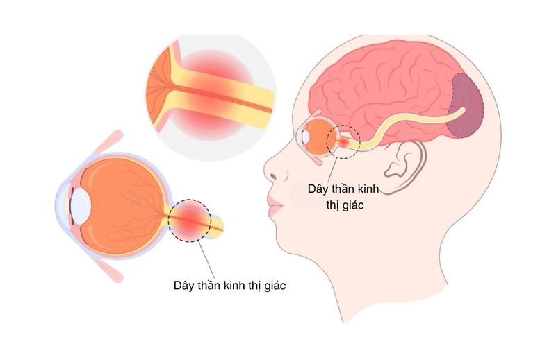 Dây thần kinh thị giác có nhiệm vụ gì 2