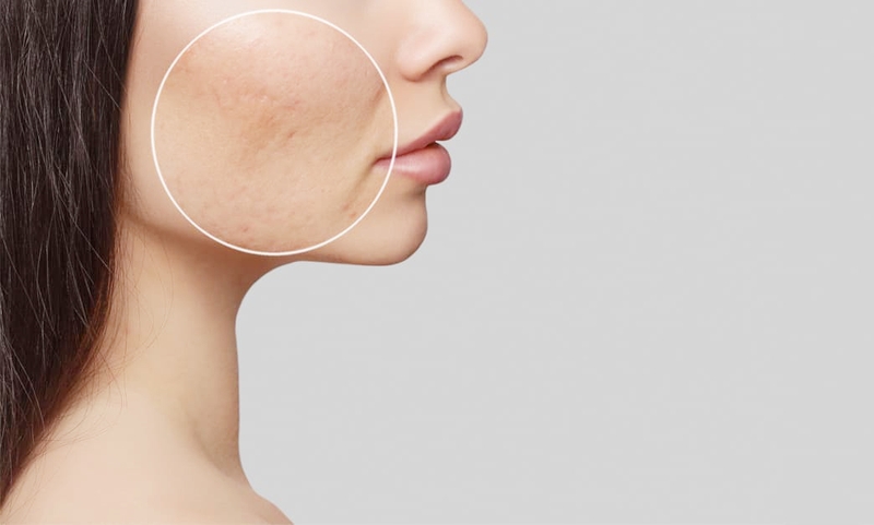 Để dưỡng da nên uống Glutathione vào lúc nào là tốt nhất? 1