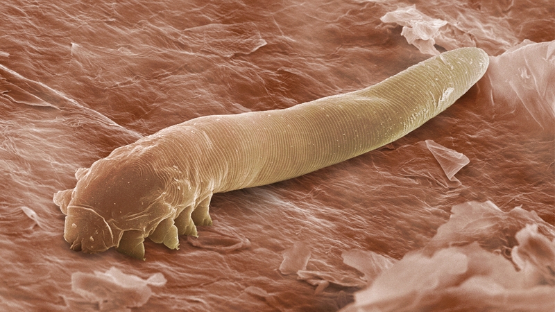 Xét nghiệm Demodex soi tươi có ý nghĩa gì? Thực hiện thế nào 1