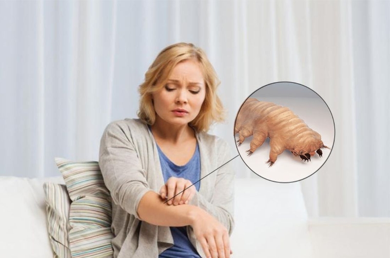 Xét nghiệm Demodex soi tươi có ý nghĩa gì? Thực hiện thế nào 3