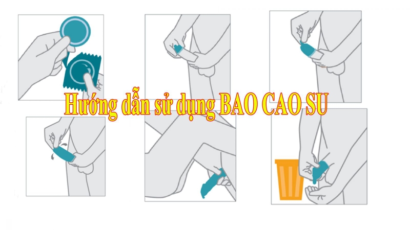 Nên thay mới khi đeo bao cao su ngược