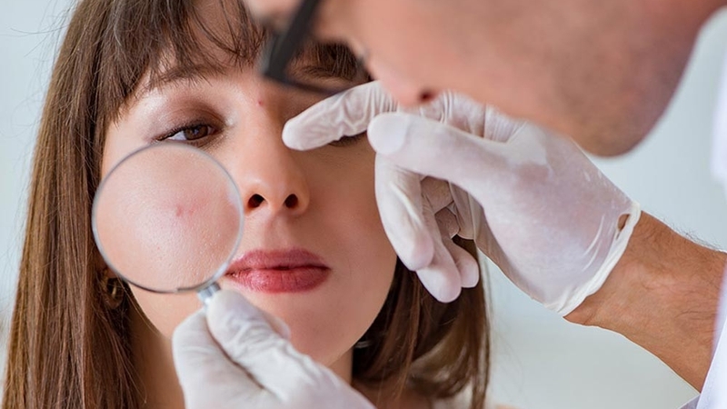 Derma forte kết hợp với BHA có hiệu quả không? 4