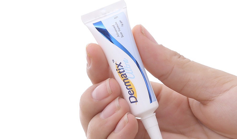 Dermatix Ultra có công dụng hữu hiệu trong việc điều trị các vết bỏng nhẹ, sưng đỏ trên da