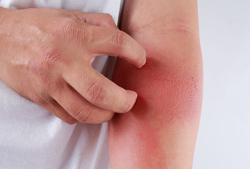 di-ung-thuoc-khang-sinh-va-nhung-dieu-can-biet-2