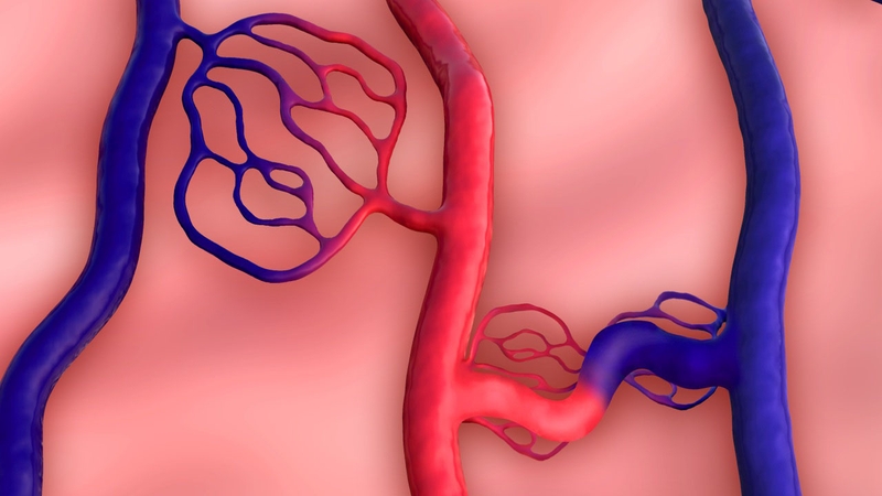 Dị dạng động mạch thận là gì? Các biến chứng có thể gặp phải 2