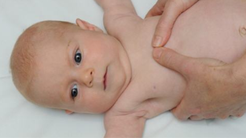 Dị dạng xương ức lồi là gì? Phẫu thuật dị dạng xương ức như thế nào? 1