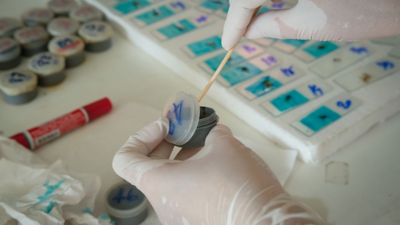 Xét nghiệm phân giúp chẩn đoán bệnh