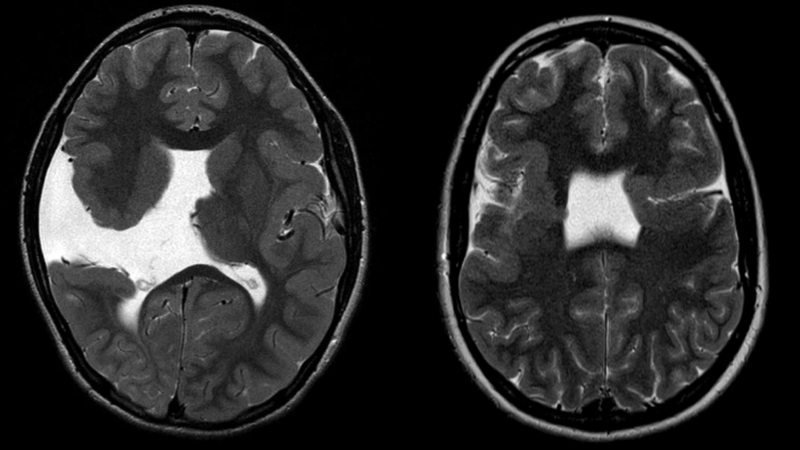 di-tat-che-nao-la-gi-va-nhung-dieu-can-luu-y 2