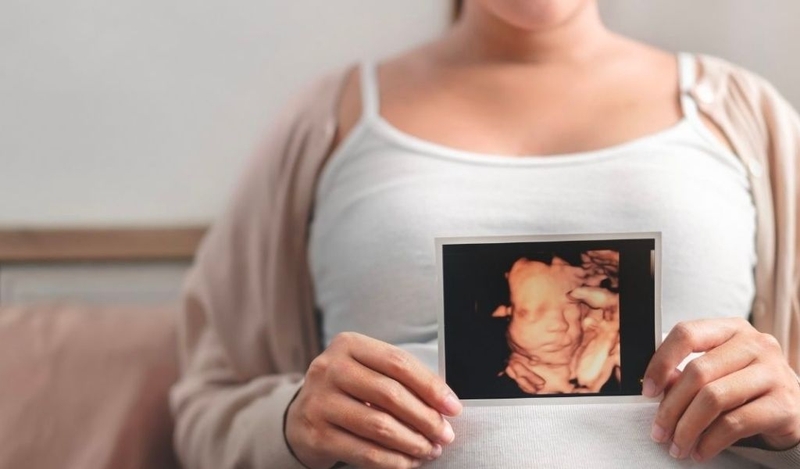 Dị tật cột sống chẻ đôi là gì? Chẩn đoán và điều trị như thế nào? 3