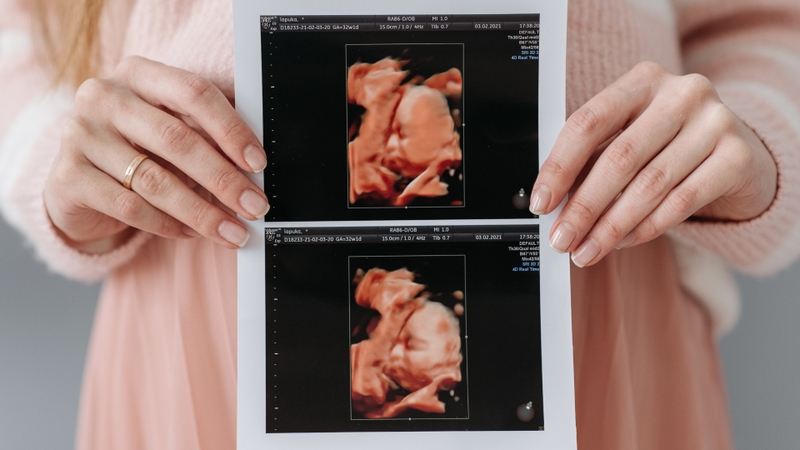 Dị tật thai nhi là những bất thường về cấu trúc hoặc chức năng xuất hiện trong quá trình phát triển của thai nhi