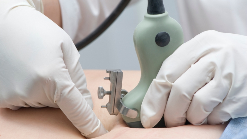 Chọc ối thường được chỉ định khi sàng lọc có nguy cơ cao hoặc có nghi ngờ trên siêu âm