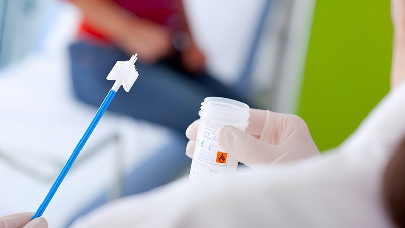 Xét nghiệm dịch niệu đạo giúp chẩn đoán chính xác nguyên nhân