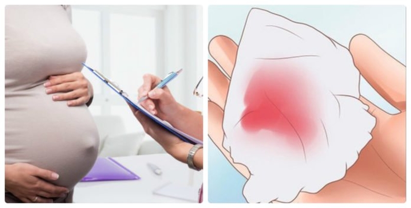 Đi tiểu buốt ra máu có phải có thai không hay là dấu hiệu của bệnh lý nguy hiểm?1