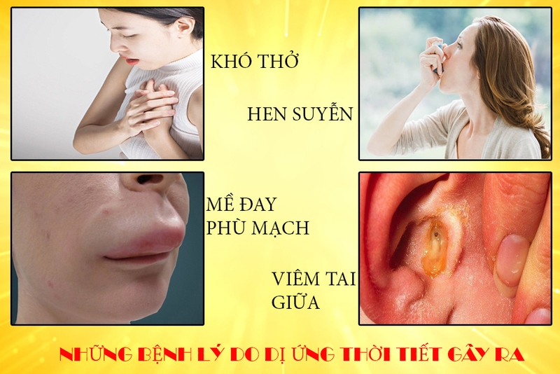 Dị ứng thời tiết có nguy hiểm không? Làm cách nào để phòng tránh?
